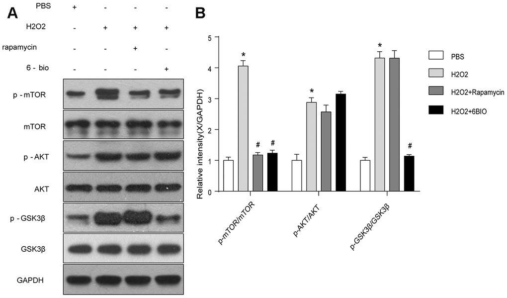 The mTOR and GSK3β signaling analyzed by Western blot. *P