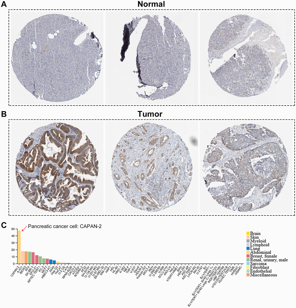 The human protein atlas database analysis. (A, B) The translational differences of B3GNT3 between pancreatic cancer tissues and normal pancreatic tissues. (C) The expression of B3GNT3 in CAPAN-2 cells was much higher than that in various other cancer cells.