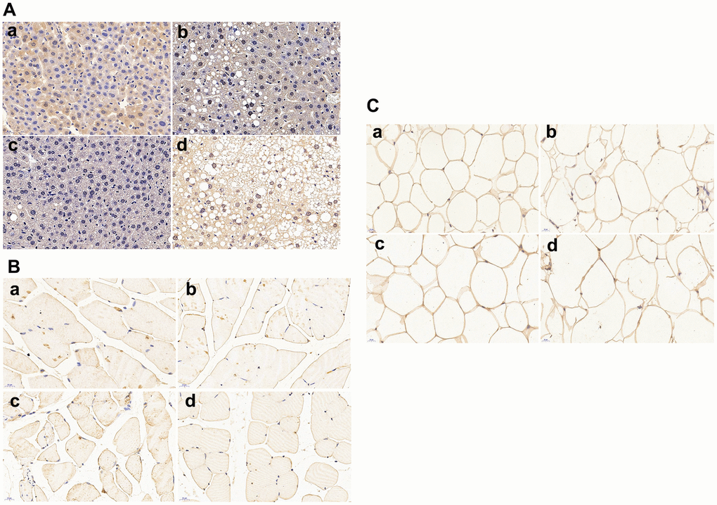 Glucose transporters (GLUTs) protein expressions in liver, skeletal muscle and omental adipocyte (n = 6 at least for each group). (A) GLUT2 protein expression in liver tissue; (B) GLUT4 protein expression in muscle; (C) GLUT4 protein expression in omental adipocytes. a: control diet-treated C57 mice; b: 60% HFD-treated C57 mice; c: control diet-treated APP/PS1 mice; d: 60% HFD-treated APP/PS1mice.Scalebar:20μm.