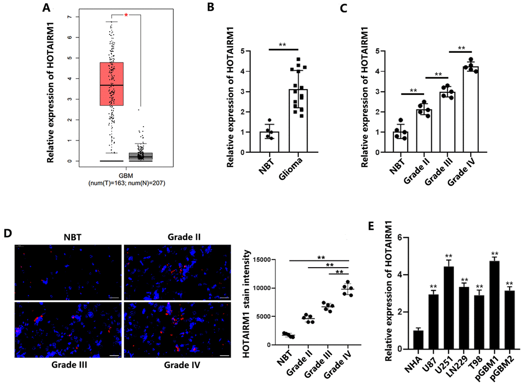 HOTAIRM1 is upregulated in GBM tissues and cells. (A) HOTAIRM1 was significantly upregulated in GBM samples (n = 163) compared with corresponding normal tissues (n = 207) according to the GEPIA database. (B) Relative HOTAIRM1 expression was analyzed in 5 normal brain tissues and 15 glioma tissues (5 grade II, 5 grade III, and 5 grade IV). (C) Relative expression of HOTAIRM1 in normal brain tissues and different grades of glioma tissues was determined. (D) Representative images of FISH analysis of HOTAIRM1 expression in normal brain tissues and different grades of glioma tissues. Scale bar = 50 μm. (E) Relative expression of HOTAIRM1 in NHAs and 6 GBM cells was determined. *P P 