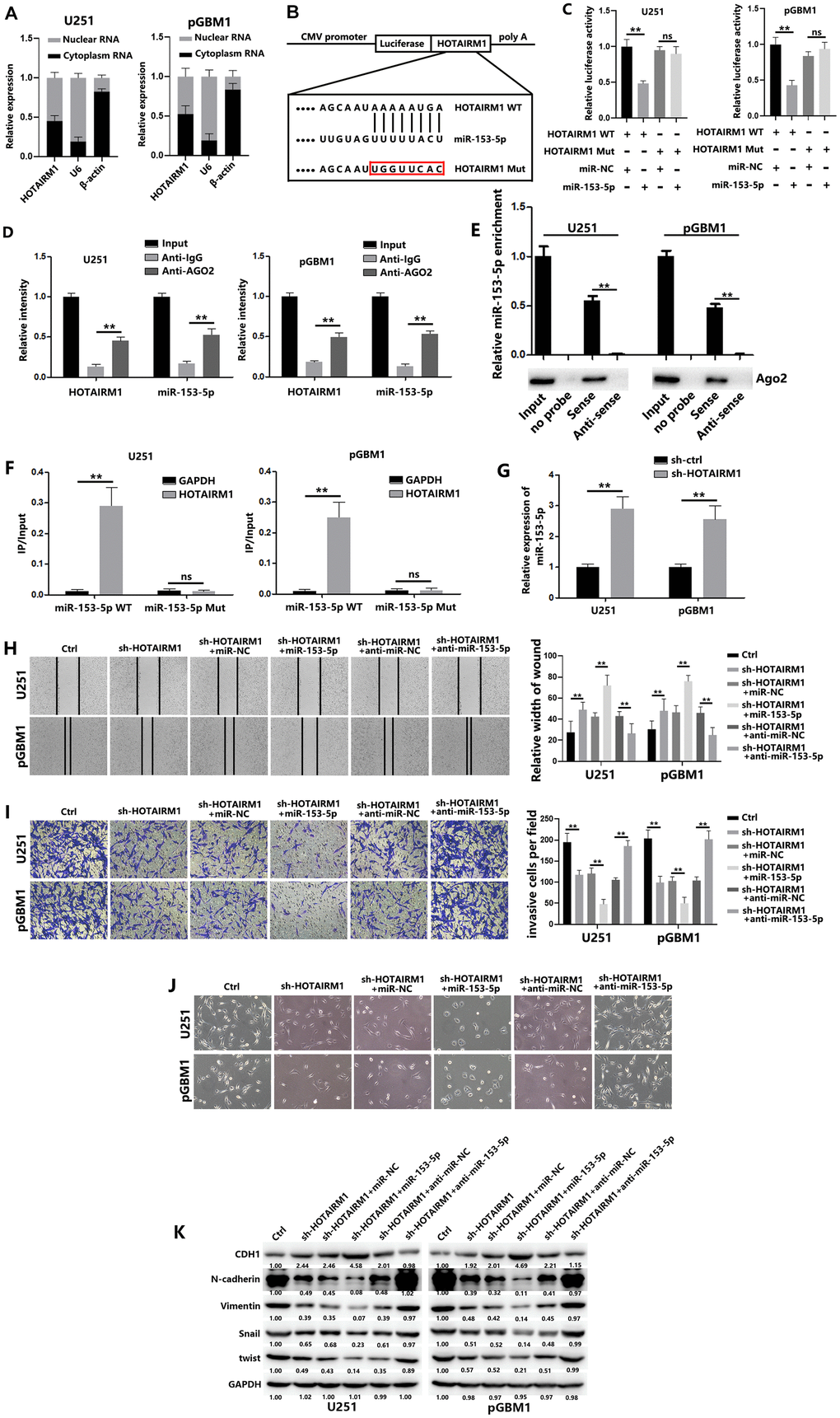 HOTAIRM1 serves as a molecular sponge for miR-153-5p. (A) HOTAIRM1 expression in the nucleus and cytoplasm of GBM cells was measured using qRT-PCR. U6 (nuclear retained) and β-actin (exported to cytoplasm) were used as controls. (B) Schematic diagram shows the putative miR-153-5p binding sites with HOTAIRM1. The sequences of wild-type HOTAIRM1 and mutant HOTAIRM1 are listed as well. (C) Luciferase reporter gene assays were performed to measure the luciferase activity in GBM cells. (D) RNA immunoprecipitation (RIP) assays were performed to determine HOTAIRM1 and miR-153-5p RNA enrichment in immunoprecipitated (IP) complex. Anti-immunoglobulin G (IgG) was used as the control. (E) Relative expression of miR-153-5p and the level of Ago2 in the products of HOTAIRM1 based pull-down assays. (F) The biotinylated miR-153-5p WT or miR-153-5p Mut was transfected into GBM cells. qRT-PCR was performed to quantify the RNA levels of HOTAIRM1 and GAPDH. Relative ratios of the input of IP were analyzed. (G) Relative expression of miR-153-5p in GBM cells was analyzed after transfection with sh-ctrl or sh-HOTAIRM1. (H) Wound healing assays were used to analyze migration of GBM cells. (I) Matrigel invasion assays were used to analyze invasion of GBM cells. (J) Morphological changes of GBM cells were imaged to analyze EMT process of GBM cells. (K) EMT-associated proteins in GBM cells were determined using western blotting. *P P 