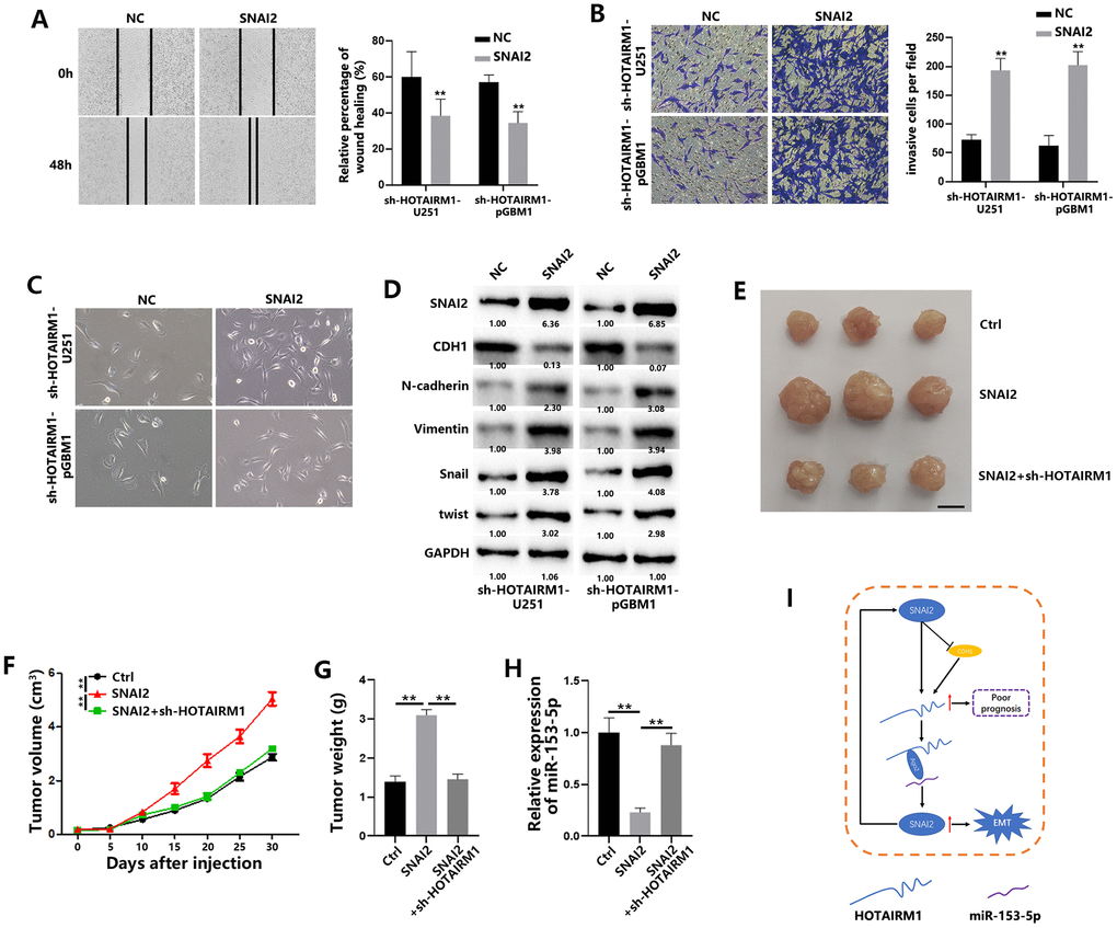 SNAI2 promotes migration and invasion of GBM cells and tumor growth in vivo. (A) Wound healing assays were used to analyze migration of GBM cells. (B) Matrigel invasion assays were used to analyze invasion of GBM cells. (C) Morphological changes of GBM cells were imaged to analyze EMT process of GBM cells. (D) EMT-associated proteins in GBM cells were determined by western blotting. (E) Representative images of subcutaneous tumors originated from transfected pGBM1 cells on the days indicated. (F) Growth curve of tumors originated from transfected pGBM1 cells. (G) Weight of tumors originated from transfected pGBM1 cells. (H) Relative expression of miR-153-5p in tumors originated from transfected pGBM1 cells. (I) Schematic illustration of proposed model depicting important role of the lncRNA HOTAIRM1 in regulating cell migration and invasion. *P P 