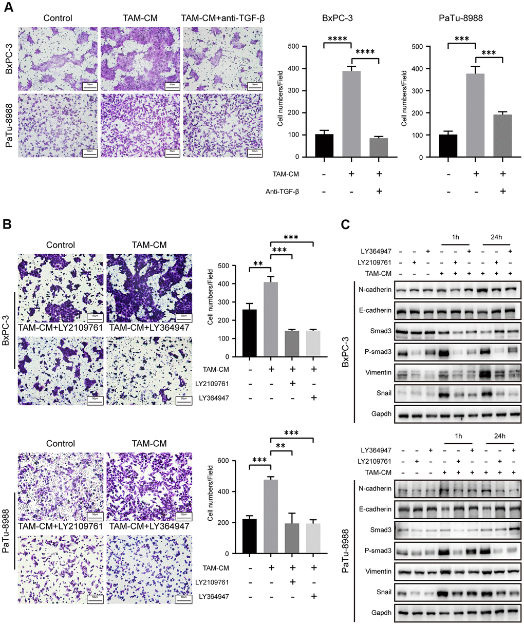 Inhibition of TGF-β signaling pathway attenuates EMT of PDAC cell lines. (A) Transwell assay results show migration and invasion ability of BxPC-3 and PaTu-8988 cells after incubation with TAM-CM in the presence or absence of the neutralizing TGF-β neutralizing antibody. Scale bar = 50 μm; ***P B) Transwell assay results show the migration and invasion ability of BxPC-3 and PaTu-8988 cells after incubation with TAM-CM in the presence or absence of TGF-β receptor inhibitors, LY364947 (1 μM) and LY2109761 (10 μM). Scale bar = 50 μm; **P C) Western blot analysis shows the expression of EMT markers (E-cadherin, N-cadherin, and Vimentin), Smad3 and phospho-Smad3 proteins in BxPC-3 and PaTu-8988 cells incubated with TAM-CM in the presence or absence of TGF-β receptor inhibitors, LY364947 and LY2109761.