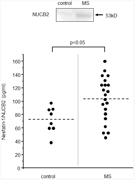 NUCB2/nesfatin-1 in the CSF of the MS patients. The expression of NUCB2/nesfatin-1 in the CSF of MS patient confirmed by western blot analysis (above). The NUCB2/nesfatin-1 levels in the control (n=10) and MS patients (n=24).