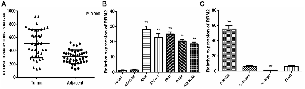 RRM2 expression in human LUAD tissues and cell lines. (A) Expression of RRM2 in 40 LUAD tissues and corresponding non-cancerous tissues were detected by qRT-PCR; (B) RRM2 expression levels in A549, SPCA-1, 95-D, PG-49, BEAS-2B, HaCaT, and NCI-H292 by qRT-PCR; (C) RRM2 expression in A549 cells transfected with si-RRM2, O-RRM2, si-NC, and O-Control were confirmed by qRT-PCR. *indicates a p-value p-value 