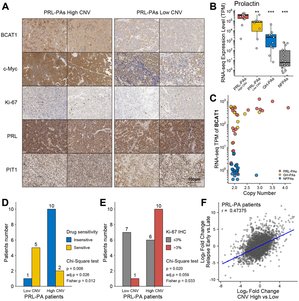 Clinical relevance of genomic copy number variation in PRL-PAs. (A) Immunohistochemistry of BCAT1, MYC, Ki-67, PRL, and PIT1 in high and low CNV PRL-PAs. ×100 magnification, the scale bar = 100 μm. (B) Prolactin expression levels (TPM) in PRL-PAs with high CNV, PRL-PAs with low CNV, GH-PAs and NFPAs. *PC) Copy number and expression level (TPM) of BCAT1 in different PA subtypes. Both copy number and expression level of BCAT1 were increased in PRL-PAs. (D) PRL-PA patients in the high CNV group more frequently developed drug resistance. The yellow bar indicates the number of patients that are sensitive to BCT treatment, while the blue bar indicates number of patients that are insensitive to the same treatment. P value = 0.026, Chi-Square test. (E) High CNV group in PRL-PAs exhibits a higher degree of malignancy. The PA malignancy was defined by the number of positive Ki-67 foci in IHC. P value = 0.059, Chi-Square test. (F) The Scatter plot shows positive correlation (spearman correlation coefficient: 0.47) of transcriptomic alterations in high CNV group relative to low CNV group (x-axis) and relapsed PAs relative to un-relapsed PAs (y-axis).