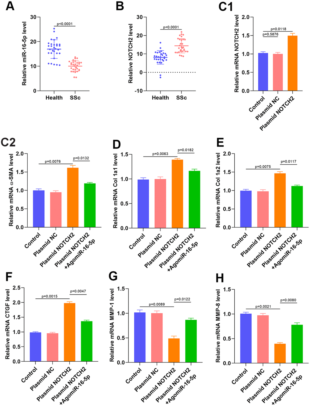 NOTCH2 is overexpressed in SSc patients and promotes fibrosis in vitro. (A, B) miR-16-5p and NOTCH2 expression in SSc patients and healthy controls (n=30 per group). (C1) The effects of NOTCH2 plasmid transfection on NOTCH2 levels in HSFs was assessed using qRT-PCR. (C2–F) Levels of collagen-related markers were measured by qRT-PCR analysis after different treatments in HSFs. (G–H) MMP levels in the different groups were measured by qRT-PCR. Data are shown as means ± SDs of three independent experiments.