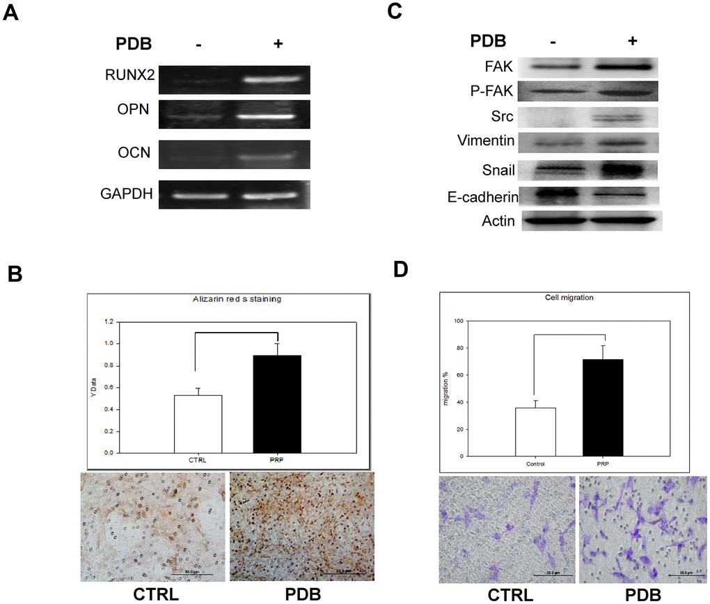 In vitro analysis of osteoblastic differentiation and cell migration of osteoblasts treated with PDB. (A) RT-PCR analysis dependent expression of osteogenic markers (RUNX2, OCN, and OPN). (B) Quantitative analysis of matrix mineralization in MEFs by alizarin Red S staining. (C) Protein expression of migratory and epithelial to mesenchymal transition (EMT) markers potential of MEFs. (D) Quantification analysis of transwell cell migration assay. The experimental group represent PDB-treatment; whereas, no any treatment served as control. The representative results of 3 experiments demonstrated mean ± SD. *P 