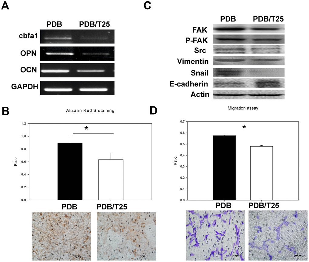 In vitro analysis of osteoblastic differentiation and cell migration of osteoblasts treated by PDB with and without inhibitor of TGF-β receptor I (Ti) in a concentration of 25nM (Ti25). (A) RT-PCR analysis dependent expression of osteogenic markers (RUNX2, OCN, and OPN). (B) Quantitative analysis of matrix mineralization in MEFs by alizarin Red S staining. (C) Protein expression of migratory and epithelial to mesenchymal transition (EMT) markers potential of MEFs. (D) Quantification analysis of transwell cell migration assay. The representative results of 3 experiments demonstrated mean ± SD. *P 