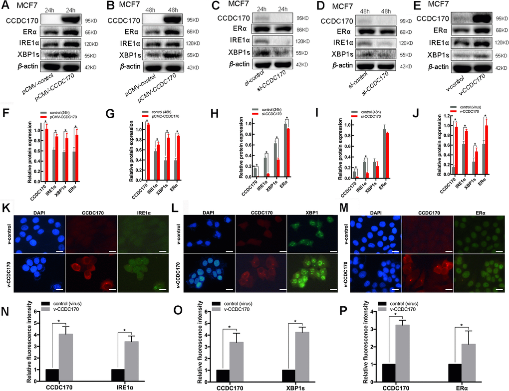 The protein expression of CCDC170, IRE1α and XBP1s in MCF7 breast cancer cells. Representative western blot bands and analysis at 24h (A, F) and 48h (B, G) of CCDC170 up-regulation, 24h (C, H) and 48h (D, I) of CCDC170 down-regulation. Representative western blot bands (E) and analysis (J) in MCF7 breast cancer cells that stably overexpressed CCDC170. β-actin was used as a reference for calculating the relative protein expression. Representative immunofluorescence images and analysis of IRE1α (K, N), XBP1s (L, O) and ERα (M, P) in CCDC170-stably-overexpressing MCF7 cells. Scale bar: 50μm. pCMV-CCDC170(control) represented CCDC170-transiently-overexpressing MCF7 cells and controls. v-CCDC170(control) represented CCDC170-stably-overexpressing MCF7 cells and controls. si-CCDC170(control) represented cells with siRNA-mediated knockdown of CCDC170 and the controls. The error bars presented as mean ± Standard Error of Mean (SEM) with analysis of unpaired Student’s t-test. *P 