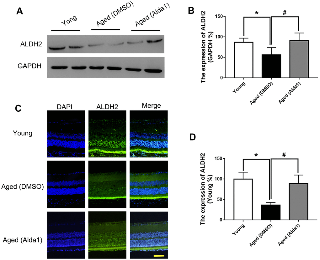 The expression of ALDH2 in the young group, aged (DMSO) group and aged (Alda1) group. (A, B) A typical ALDH2 WB image and the expression of ALDH2; (C, D) A typical ALDH2 immunofluorescence image and the expression of ALDH2. All analyses were performed in duplicate. Scale bar: 50 μm. Values are presented as the mean ± SD, n = 4 mice per group. *Pvs young group; #Pvs aged (DMSO) group.