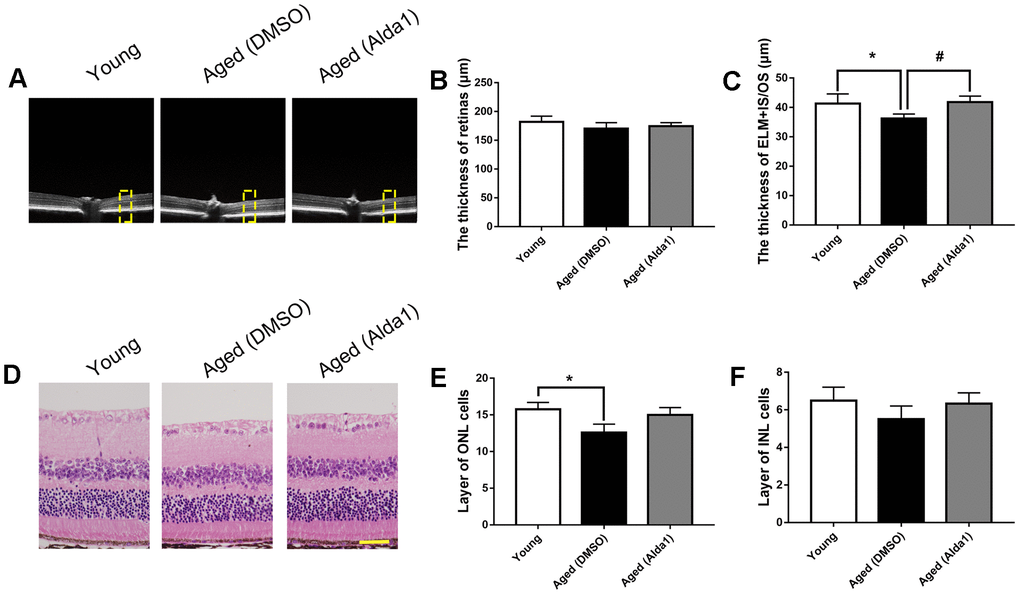 The retinal structures in Alda1-treated aged mice. (A) A typical marked OCT image; (B) The thickness of the total retina; (C) The thickness of the ELM+IS/OS. (D) A typical marked HE staining image; (E) The number of ONL cell layers; (F) The number of INL cell layers. All analyses were performed in duplicate. Scale bar: 50 μm. Yellow box showed retinal structure analysis area. Values are presented as the mean ± SD, n = 6 mice per group. *Pvs young (WT); #Pvs aged (WT).