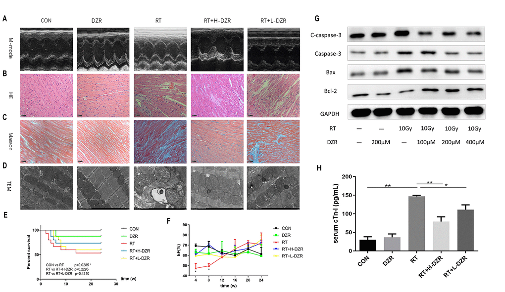 Dexrazoxane decreases functional damage and structural injury in the rat heart after irradiation. (A) Representative M-mode echocardiograms for each group. (B, C) Representative HE and Masson staining (×200, scale bar =100 μm) of hearts from each group (n=7-11, respectively). (D) Subcellular abnormalities in mitochondria, sarcomeres, and myofilaments identified by TEM (×10K). (E) Kaplan-Meier analysis of rat survival in each group. Exposure to whole heart irradiation significantly reduced overall survival time (CON vs RT, p =0.029). A non-significant trend for a long-term survival benefit of DZR was observed. (F) Irradiation significantly decreased EF in rats within 8 weeks. No significant differences were observed among the groups (n=3 at every time point for each group) after 8 weeks. (G) H9C2 cells were pre-treated with or without DZR (100, 200, and 400 μM) before a single 10 Gy X-ray irradiation. 24 h after irradiation, radiation-induced apoptosis-related injuries were reduced in cardiomyocytes pre-treated with 200 and 400 μM DZR. (H) Serum levels of cardiac troponin I (cTnI) were assessed at week 24 after irradiation. cTnI levels in CON and DZR groups were 30.13 ± 7.94 and 36.58 ± 8.97 pg/mL (n=5), respectively. Irradiation significantly increased cTnI levels in irradiated rats. cTnI levels were as follows: 147.00 ± 2.46 pg/mL in RT group (vs CON, pppp p 