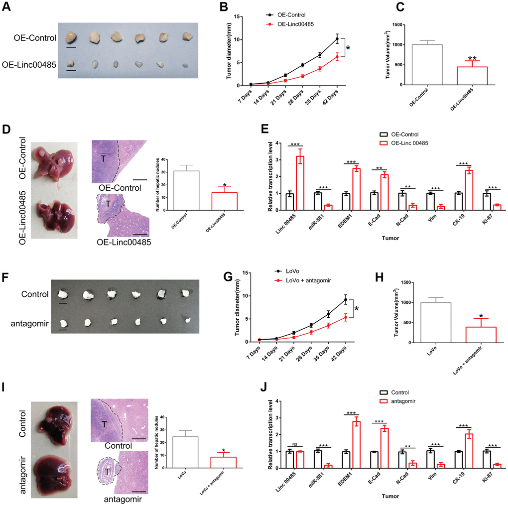 The effects of LINC00485 overexpression and miR-581 knockdown on CRC cell growth and liver metastasis in vivo. (A) Representative images of tumors derived from LINC00485-overexpressed LoVo cells at day 42 after subcutaneous injection (n=6 per group). (B) Tumor diameter was measured weekly after subcutaneous of injection LINC0048-overexpressed LoVo cells into the dorsal side of nude mice (n=6 per group). (C) Tumor volume of CRC tissues derived from LINC00485-overexpressed LoVo cells detected at day 42. (D) The number of hepatic nodules were counted in paraffin sections of liver at day 28 after injection with LINC00485-overexpressed LoVo cells into the spleen of the mice (n=6 per group). (E) The mRNA expression levels of LINC00485, miR-581, EDEM1, cytokeratin, E-cadherin, N-cadherin, and vimentin in hepatic nodules following injection of LINC00485-overexpressed LoVo cells into the spleen of the mice (n=6 per group). (F) Representative images of tumors derived from LoVo cells at day 42. Nude mice bearing xenograft tumors received miR-581 antagomir once a week (n=6 per group). (G) Tumor diameter in LoVo-bearing nude mice with administration of miR-581 antagomir once a week (n=6 per group). (H) Tumor volume of LoVo-bearing nude mice with administration of miR-581 antagomir was evaluated at day 42. (I) The number of hepatic nodules in a CRC liver metastases mouse model at day 28 after injection of LoVo cells into the spleen of the mice (n=6 in each group). Mice received miR-581 antagomir once a week for 4 weeks. (J) The mRNA expression levels of LINC00485, miR-581, EDEM1, cytokeratin, E-cadherin, N-cadherin, vimentin and Ki-67 in hepatic nodules in a CRC liver metastases mouse model at day 28 after injection of LoVo cells into the spleen of the mice (n=6 in each group). Then, the mice received miR-581 antagomir once a week for 4 weeks. Data were analyzed using student’s t-test. Bars were represented as S.D. *PPP