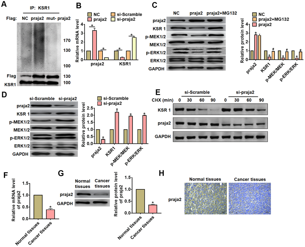 Praja2 promoted ubiquitylation of KSR1. (A) HA-ubiquitin and Flag- praja2 or Flag-mut-praja2 was transfected into HEK293 cells. IP analysis for the relation between praja2 and KSR1. (B) Praja2 or si-praja2 or its NC was transfected into MKN-45 cells, and qRT-PCR analysis for the expression of KSR1. (C) Praja2 or NC was transfected into MKN-45 cells with or without the presence of MG132. Western blot was used to detect praja2, KSR1, MEK, p-MEK, ERK and p-ERK protein level. (D) si-praja2 or si-NC was transfected into MKN-45 cells, and western blot for the expression of praja2, KSR1, MEK, p-MEK, ERK and p-ERK protein. (E) CHX assay was used to determine the role of praja2 on KSR1 stability. (F, G). The expression of praja2 in normal and cancer tissues was detected by qRT-PCR and western blot. (H) IHC for praja2 in normal and cancer tissues of GC. Scale bar, 40 μm.