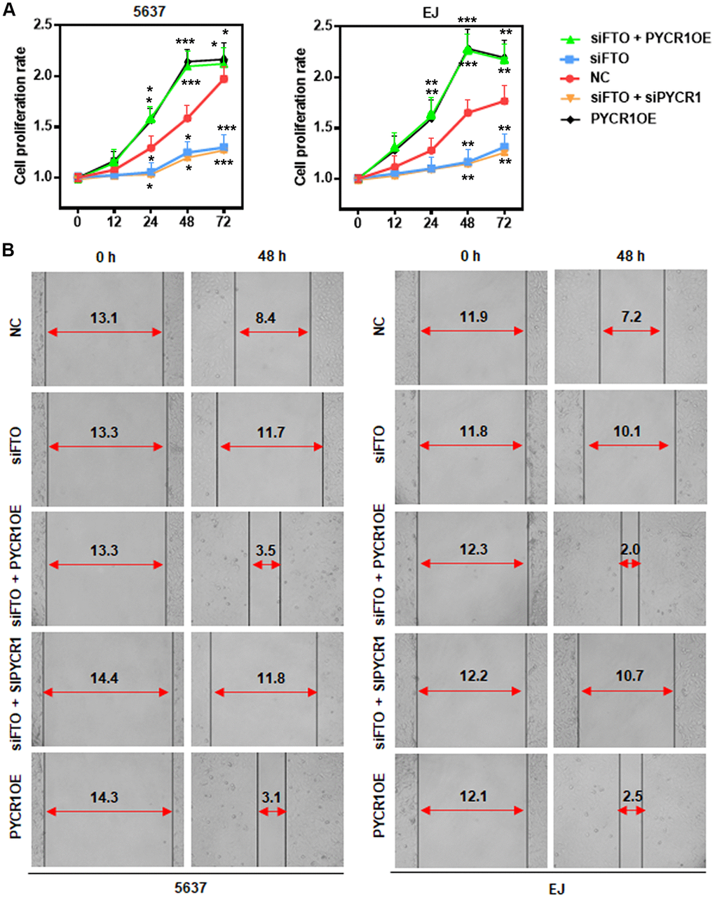 PYCR1 restores FTO-depleted BLCA cell defects in proliferation and migration. (A) MTT assay determining the role of PYCR1 in BLCA cell proliferation. (B) Wound-healing assay assessing the effect of PYCR1 in BLCA cell migration.