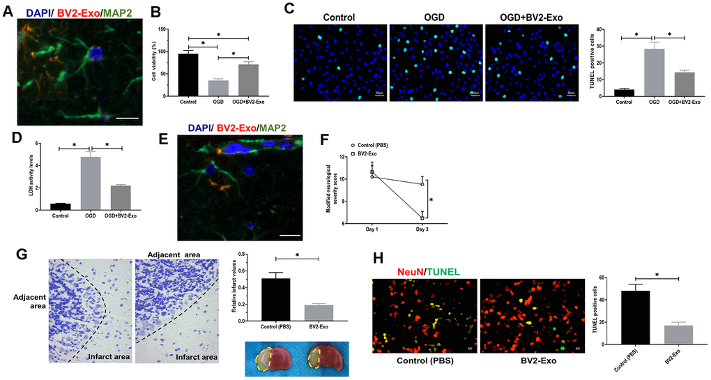 M2-phenotype microglia-derived exosomes (BV2-Exo) attenuated neuronal apoptosis induced by ischemic injury. (A) BV2-Exo was internalized by neurons in vitro, as imaged by confocal microscopy. Red color indicated exosomes (PKH26), blue color indicated nuclei (DAPI), and green color indicated neurons (MAP2). Scale bar = 25 μm. (B) Cell viability of neurons treated with OGD or OGD plus BV2-Exo, as determined by CCK-8 assay. (C) TUNEL assay for detecting apoptosis in neurons treated with OGD or OGD plus BV2-Exo. Scale bar = 20 μm. (D) Lactate dehydrogenase (LDH) assay for detecting LDH activity in neurons treated with OGD or OGD plus BV2-Exo. (E) BV2-Exo was internalized by neurons in vivo, as imaged by confocal microscopy. Red color indicated exosomes (PKH26), blue color indicated nuclei (DAPI), and green color indicated neurons (MAP2). Scale bar = 25 μm. (F) Modified neurological severity score for mice treated with control treatment (PBS) and BV2-Exo after tMCAO. (G) Relative infarct volume in brains of mice treated with control treatment (PBS) and BV2-Exo after tMCAO, displayed as brain cresyl violet staining and brain tissues of ischemic mice treated with indicated treatments. Yellow dotted boxes represent the infarct areas. (H) Double-staining of NeuN/TUNEL in brain sections of mice treated with control treatment (PBS) and BV2-Exo after tMCAO. Red color indicated NeuN and green color indicated TUNEL staining. Scale bar = 25 μm. Data are presented as mean±SD. *, p