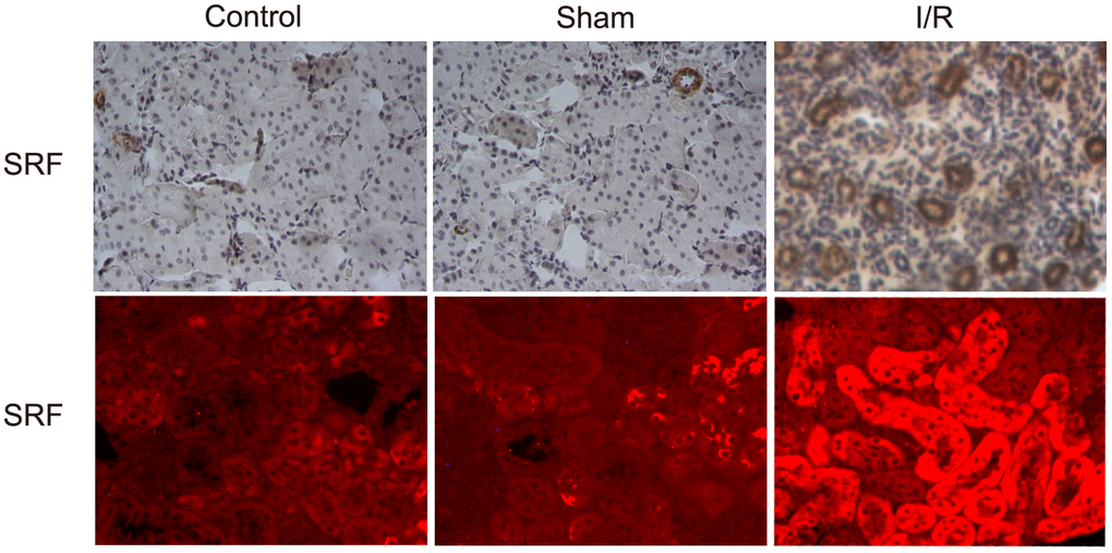 SRF was upregulated and localized in TECs in I/R rats. Location of SRF in kidney 6 h after I/R as evidenced by IHC and IF staining. Data are representative of at least three separate experiments.