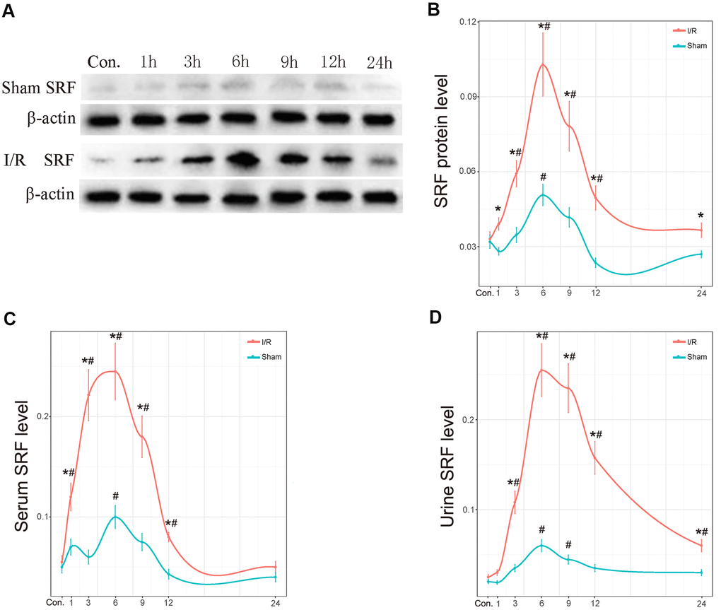 The protein level of SRF in kidney, urine and serum in vivo. (A, B) Protein expression level of SRF in kidney as measured by western blot and quantitative analyses. (C) The expression of SRF in serum. (D) The expression of SRF in urine. The trend line was calculated by local polynomial regression fitting. Data are expressed as the mean ± SE (N=7 in each group). *P#P