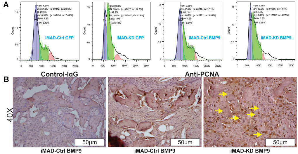 HOTAIR knockdown switches cell cycle and up-regulates PCNA expression of iMAD cells. (A) Cell cycle analysis. Subconfluent iMAD-KD and iMAD-Ctrl were infected with Ad-BMP9 or Ad-GFP. At 36 h after infection, cells were collected, fixed, stained with Hoechst 33342, and subjected to FACS analysis. Assays were done in triplicate, and representative results are shown. (B) Immunohistochemical (IHC) expression analysis of cell proliferation marker PCNA. The retrieved bone masses were sectioned and subjected to IHC staining with either a negative control IgG or PCNA antibody. Representative results are shown. Yellow arrows show positive staining cells.