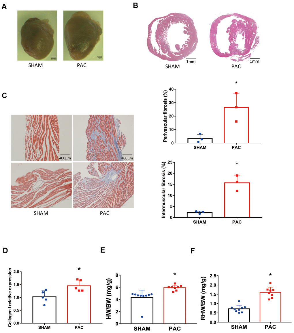 Pulmonary artery constriction induced right ventricular (RV) morphology alterations. (A) Representative right ventricular hypertrophy at 4 weeks after pulmonary artery constriction (PAC). (B) Hematoxylin and eosin (H&E) staining of RV tissue. (C) Azan-Masson staining of the RV in intermuscular and perivascular parts and their corresponding fibrotic area percentage. (D) Gene expression level of collagen I. (E) The heart weight to body weight ratio (HW/BW). (F) The right heart weight to body weight ratio (RHW/BW). *P A and B, scale bar = 400 μm for panel C.