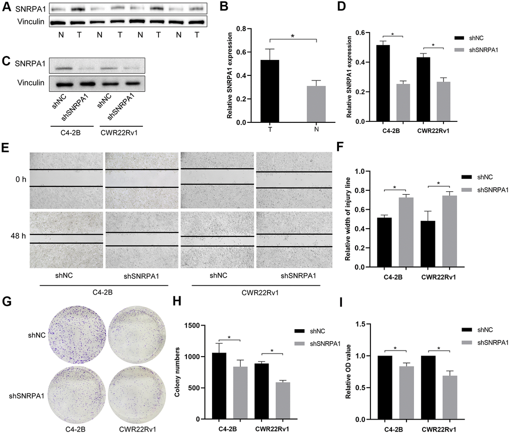 External validation of SNRPA1 in molecular experiments. Representative immunoblot (A) and quantification (B) of SNRPA1 expression between PCa and normal clinical samples. Representative immunoblot (C) and quantification (D) of SNRPA1 expression after shRNA transfection in CWR22Rv1 and C4-2b cells. Representative results of scratch assay (E) and quantification (F) of CWR22Rv1 and C4-2b cells. Representative results of colony formation (G) and quantification (H) of CWR22Rv1 and C4-2b cells. (I) The results of cell proliferation using cell counting kit-8 of CWR22Rv1 and C4-2b cells after 48 hours. Data are expressed as means ± SD. *P 