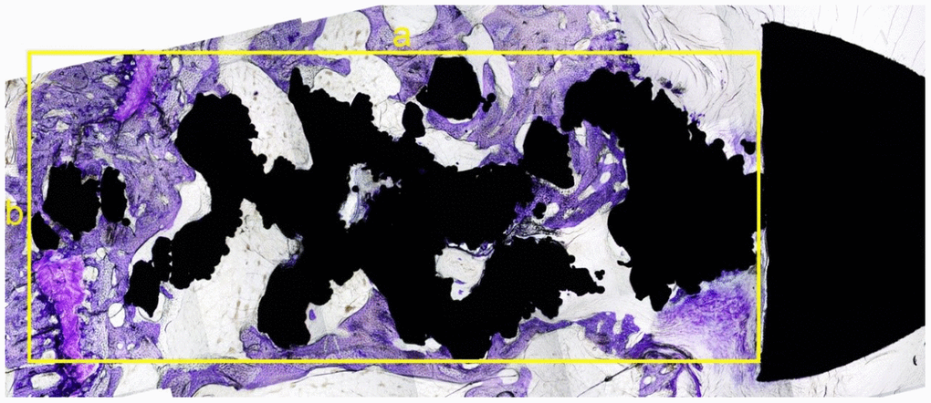 The sagittal slice of histological section of the screw. The black area was the screw (the nut is on the right) and the dyed area (purple) was the bone in-growth tissue. A rectangle was made that can contain part of the screw, without the nut. The longest diameter was measured as a (mm) with the widest diameter as b (mm) (yellow lines). The total area was as S0 = a × b (mm2). The software Image-Pro Plus was used to calculate the tissue area, which was colored by toluidine blue in this rectangle. The percentage of bone in-growth area was defined as S % =S1/S0 x 100%.