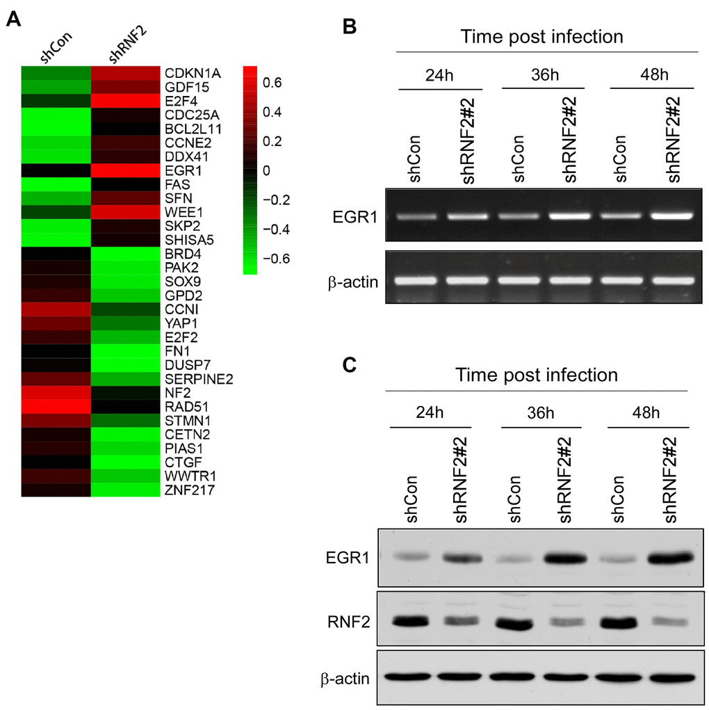 The downregulation of RNF2 induced EGR1 expression. (A) Heat map of some of the most differentially expressed genes in shRNF2-treated HCT116 cells, determined through microarray analyses (red: upregulated; green: downregulated). (B) RT-PCR analysis showing the increased EGR1 mRNA levels in RNF2-knockdown HCT116 cells. (C) Western blot showing the increased EGR1 protein levels in RNF2-knockdown HCT116 cells.