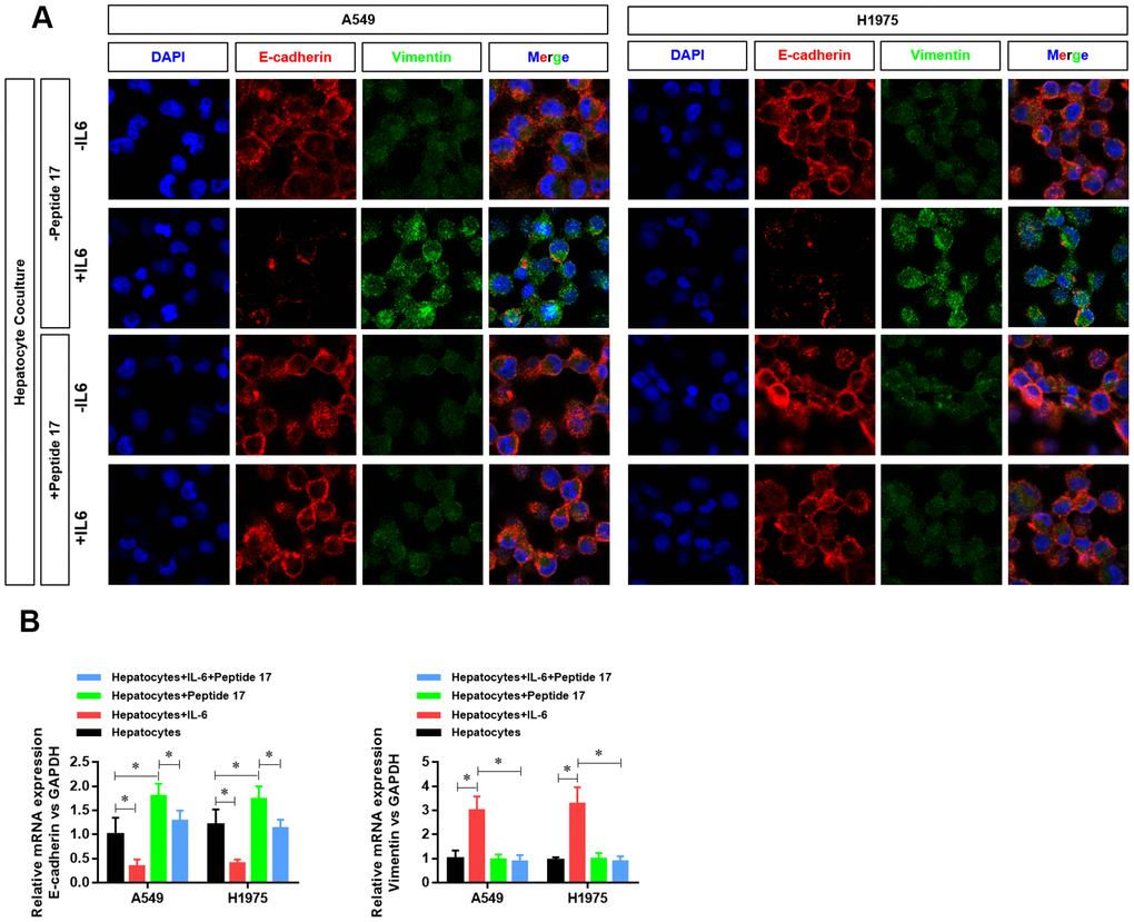 YAP1 inhibition suppressed the ability of the hepatic inflammatory microenvironment to promote EMT. (A) Changes in the expression of the EMT indexes E-cadherin and vimentin in A549 and H1975 cells were detected by confocal laser scanning microscopy (×630). (B) Changes in CDH1 and VIM mRNA expression in A549 and H1975 cells were detected by real-time PCR (*P