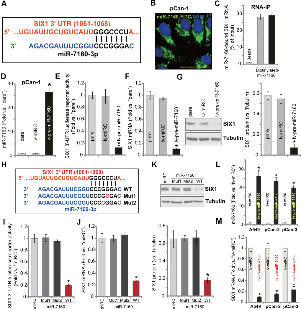 miR-7160 binds and silences SIX1 in NSCLC cells. miR-7160 (-3p) putatively targets 3’-UTR of SIX1 (position of 1061-1068) (A). Immuno-fluorescence results showed that miR-7160 localized in the cytoplasm in pCan-1 NSCLC cells (B). Biotinylated-miR-7160 immunoprecipitated with SIX1 mRNA in pCan-1 cells (C). Stable pCan-1 NSCLC cells, bearing a pre-miR-7160-expression lentiviral construct (“lv-pre-miR-7160”) or non-sense miRNA control lentiviral construct (“lv-miRC”), were established, expression of listed genes was tested by qPCR and Western blotting analyses (D, F, G), with SIX1 3’-UTR luciferase reporter activity tested as well (E). pCan-1 NSCLC cells were transfected with 500 nM of the wild-type (WT) or the mutant miR-7160 mimics (sequences listed in H), after 48h the SIX1 3’-UTR luciferase reporter activity (I) and its expression (J, K) were tested. A549 cells or primary NSCLC cells (pCan-2/pCan-3) were infected with lv-pre-miR-7160 or lv-miRC for 48h, expression of miR-7160 (L) and SIX1 mRNA (M) was tested by qPCR. “pare” stands for the parental cells (same for all Figures). Data were presented as mean ± SD (n=5), and results normalized. *PB).