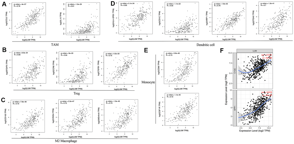 LUM expression correlated with macrophage polarization in COAD. Markers include (A) CCL2 and IL10 of TAMs (tumor-associated macrophages); (B) FOXP3, CCR8, and TGFB1 of Tregs; (C) CD163, VSIG4, and MS4A4A of M2 macrophages; (D) HLA-DPB1, CD1C, NRP1, and ITGAX of DCs; (E) CD86 and CSF1R of monocytes; (F) C1QC and SPP1 of TAM subtypes.