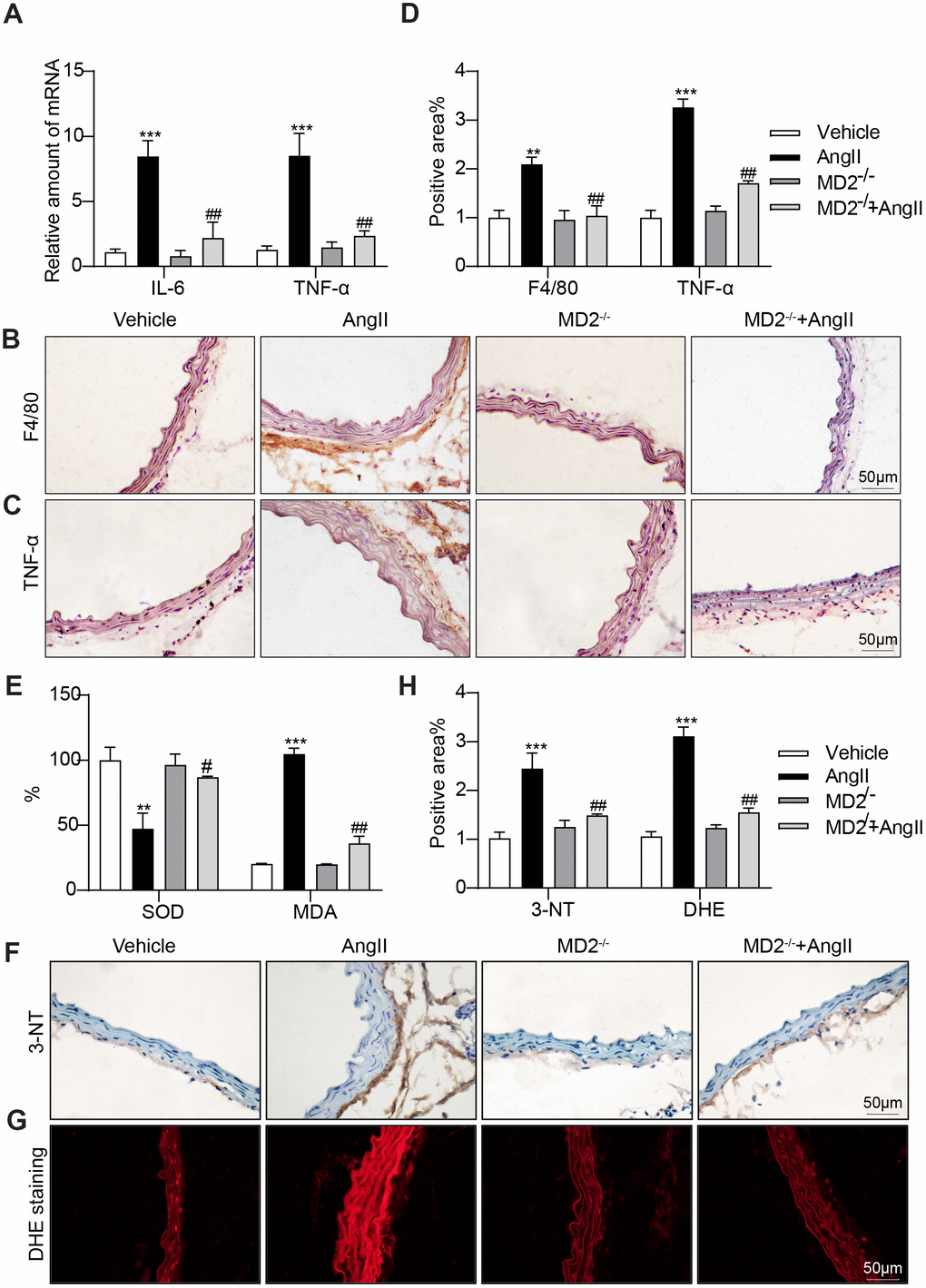 MD2 deficiency alleviated Ang II induced inflammation and oxidative stress in vivo. (A) TNF-α and IL-6 mRNA levels in the aortas were detected using real-time qPCR assay (n = 10; ***pB, C) Representative images of F4/80 and TNF-α staining of aortas (scale bar = 50 μm; DAB chromogen staining (brown)). (D) Quantification for staining results in 3B-C ((n = 10; **pE) Levels of superoxide dismutase (SOD) and malondialdehyde (MDA) in the aortas (n = 10; **pF) Oxidative damage in the aortas as assessed by immunoreactivity to 3-nitrotyrosine (3-NT). Detection was performed by DAB (brown) (scale bar = 50 μm). (G) Representative images of dihydroethidium (DHE) staining in the aortas (scale bar = 50 μm). (H) Quantification for staining results in 3F-G (n = 10; ***p