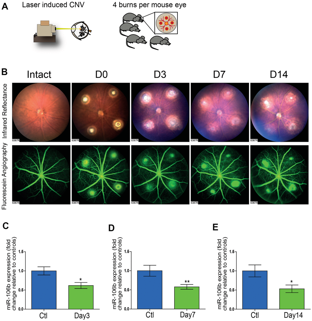 The initiation of retinal neo-vascularization is associated with downregulation of miR-106b expression. (A) Schematic of laser burn CNV mouse model. (B) Representative retinal fundus of a mouse before and after undergoing laser-induced choroidal neovascularization. Serial images depict the progression of neovascularization over a time-course of 14 days in the same eye. Choroidal expression of miR-106b by qPCR relative to intact controls assessed (C) 3 days after burns (n=8), (D) 7 days after burns (n=13) and (E) 14 days after burns (n=10); Scale bar = 50μm. Data are expressed as the mean ± S.E.M. Unpaired Two-tailed Student’s t-test was used for the analysis, *P 