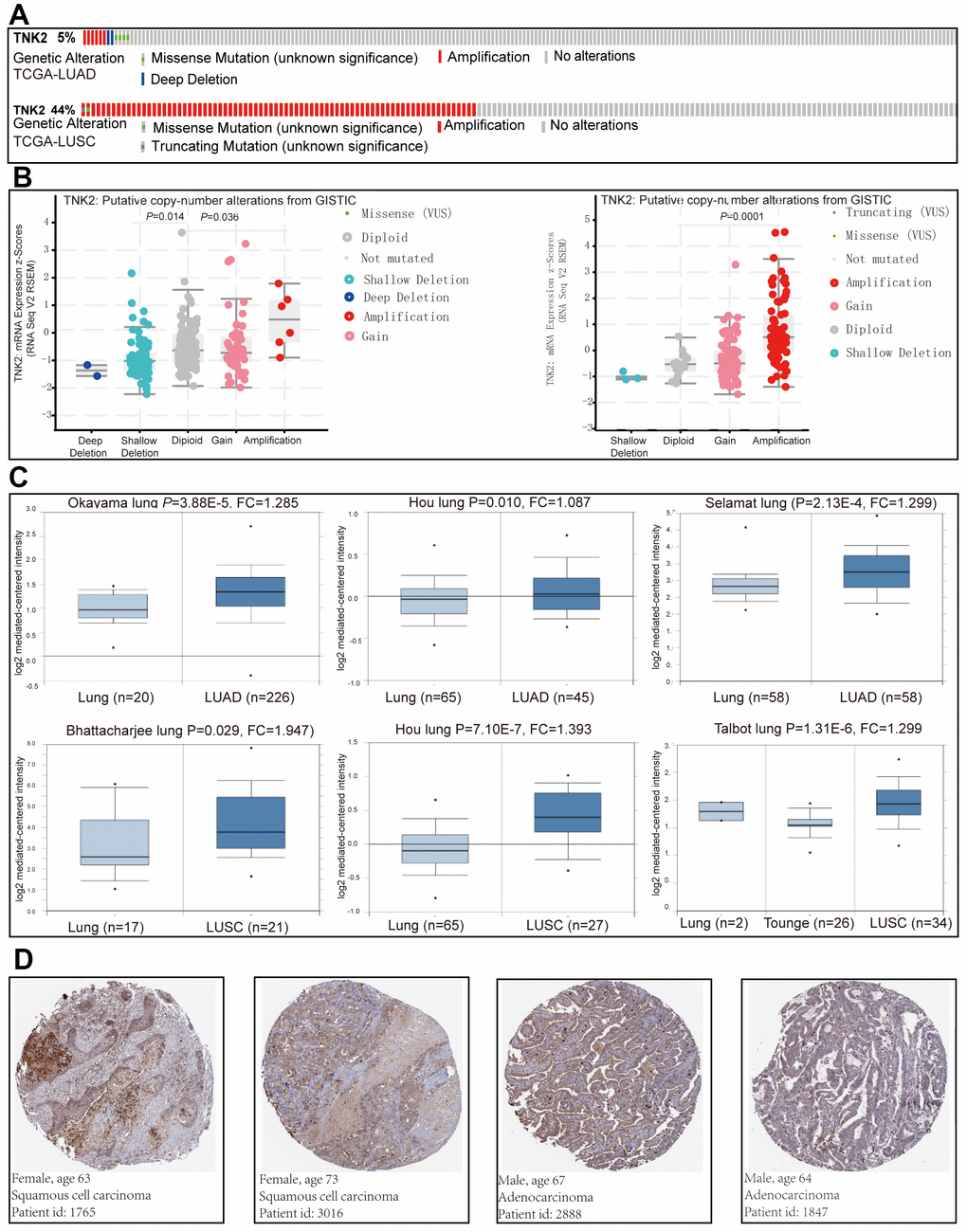 The implication of ACK1 in NSCLC. Genetic alterations of the ACK1 gene in the TCGA-LUAD and TCGA-LUSC cohorts (A) (https://www.cbioportal.org). The association between ACK1 gene copy number and mRNA expression levels (B). Significantly elevated mRNA expression levels of the ACK1 gene in lung cancer in comparison with normal tissues in the independent cohorts from the Oncomine database (C). Immunohistochemistry of ACK1 in lung cancer (D, Human Protein Atlas). Abbreviation: FC, fold change.