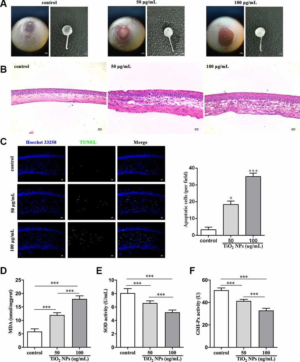 TiO2 NPs damaged corneas in vivo. (A) Images of eyeballs after indicated treatment in vivo, bar = 0.1 cm. (B) Histological observation of corneas with HE staining after TiO2 NPs treatment, bar = 20 μm. (C) Detection of apoptotic cells in cornea of TiO2 NPs-treated mice with TUNEL staining, bar = 20 μm. Measurement of MDA content (D), SOD activity (E) and GSH-Px activity (F) in vivo. *P