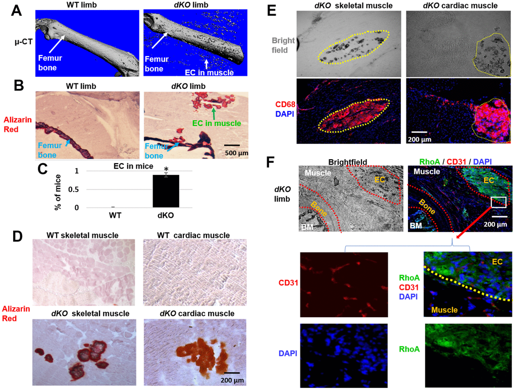 Increased macrophage accumulation at sites of ectopic calcification in skeletal muscle of dKO mice. (A). Micro-CT scanning results indicating increased ectopic calcification and osteoporosis in the hindlimb of dKO mice, compared to WT mice. (B) Alizarin Red staining of hindlimb tissue sections validate the presence of ectopic calcification in dKO mice. (C) Percent of mice that exhibit ectopic calcification (EC) in hindlimbs of dKO mice and WT mice. (D) Alizarin Red staining of skeletal muscle (gastrocnemius) and cardiac muscle (septum) showing ectopic calcification (EC). (E) Immunostaining of dKO skeletal muscle and heart sections with CD68 antibody and bright field imaging showing the extensive accumulation of CD68+ macrophages at the sites of ectopic calcification (EC). (F) Immunostaining of dKO hindlimb sections with RhoA and CD31 antibodies and bright field imaging showing the increased accumulation of RhoA+ cells at the sites of ectopic calcification (EC). n=8 for both WT and dKO mice (8-week old).*=p