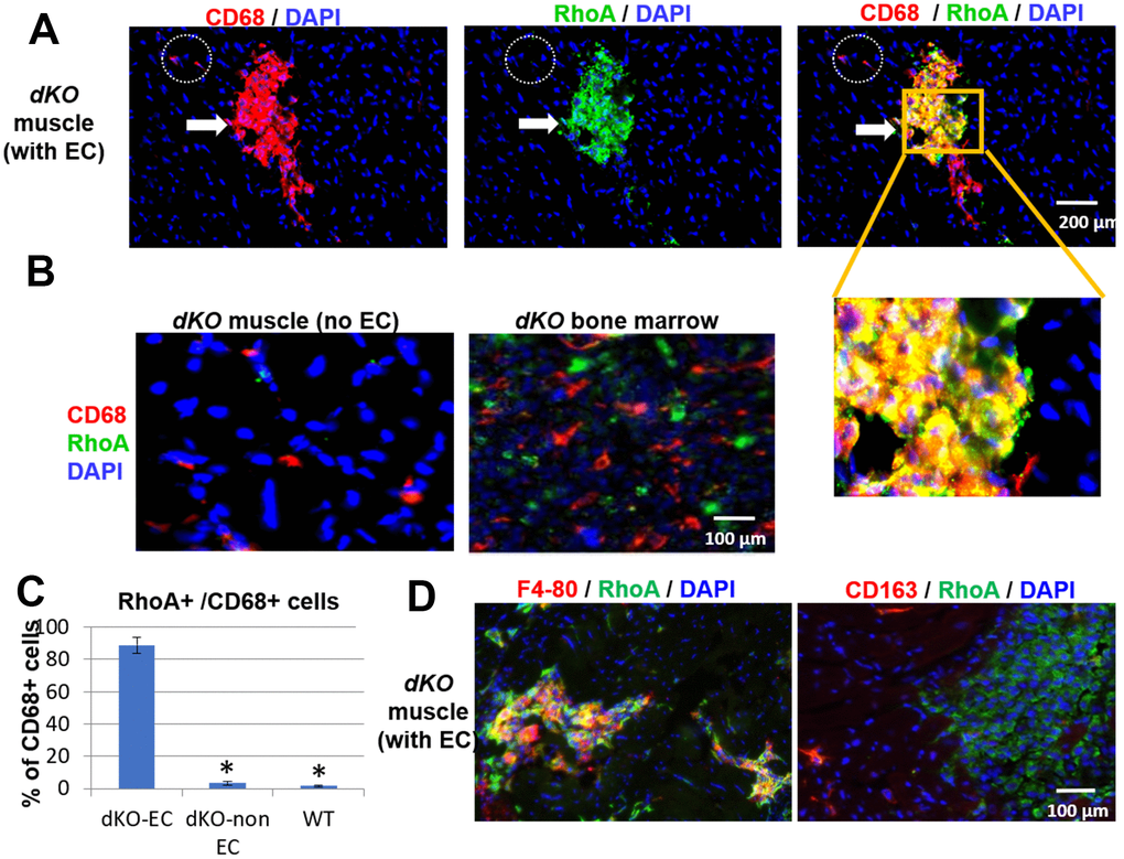 CD68+ cells at the sites of muscle calcification in dKO mice are positive for RhoA expression. (A) Immunostaining of dKO skeletal muscle (gastrocnemius) sections with RhoA and CD68 antibodies indicating that many of the accumulated CD68+ cells at sites of ectopic calcification (EC) are also RhoA+. (B) Immunostaining of dKO skeletal muscle and bone marrow sections with RhoA and CD68 antibodies showing that CD68+ cells distant from ectopic calcification or those found in bone marrow are negative for RhoA expression. (C) Immunostaining of dKO skeletal muscle with RhoA/F4-80 or RhoA/CD163 antibodies indicating RhoA+ cells are usually positive for F4-80, but negative for CD163 (a marker for M2 macrophages). (D) Quantification of RhoA+/CD68+ cells among CD68+ cells at locations of muscle with or without EC formation. * indicates p