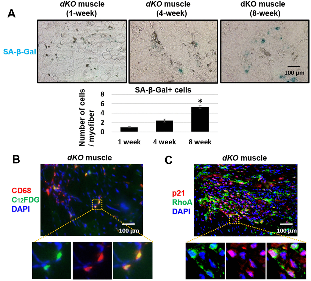 Macrophages accumulating in dystrophic muscles have increased expression of senescence markers. (A) SA-β-Gal staining of gastrocnemius muscle sections from 1, 4, and 8 week old dKO mice with quantification. Significant changes in SA-β-Gal staining was observed by 8 weeks. (B) Immunofluorescent staining of gastrocnemius muscle sections from 8-week old dKO mice indicating co-localization of the senescence marker C12FDG and CD68. ~26% of CD68+ cells are C12FDG+. (C) Immunofluorescent staining of muscle sections from 8 week old dKO mice indicating co-localization of the senescence marker p21 and RhoA. ~78% of RhoA+ cells are p21+. n=6 for 1-week and 4-week old mice, and n=8 for 8-week old mice. * indicates p