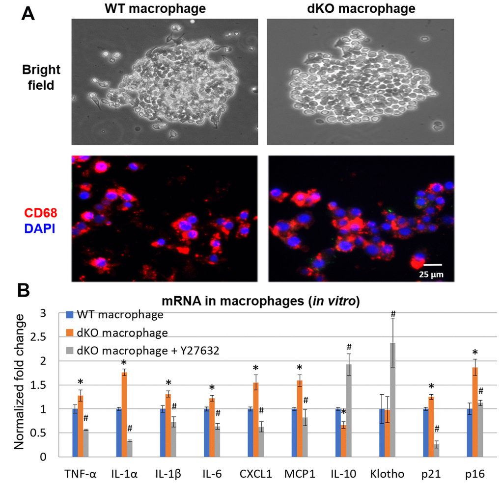 In vitro inhibition of RhoA/ROCK in dKO macrophages reduced expression of SASP factors. (A) Cultured macrophages isolated from WT and dKO mice obtained by FACS with CD68 immunostaining to validate macrophage isolation in vitro. (B) qPCR results indicating dKO macrophages exhibit up-regulated expression of SASP factors that was reduced by treatment with the RhoA/ROCK inhibitor Y-27632 (10 μM, 2 days). * indicates pdKO.