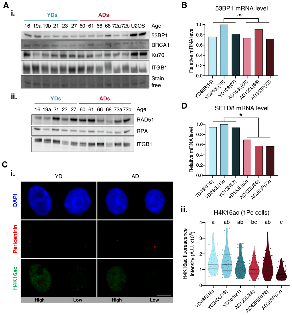 Expression levels of 53BP1, SETD8 and H4K16ac. (A) Western blot analysis of c-NHEJ and HR factors. Basal levels of (i) high and (ii) low molecular weight DNA repair proteins. Stain-free technology and/or Integrin β1 (ITGB1) have been used for sample normalization and U2OS cells were used as a positive control. (B, D) RT-qPCR analysis of 53BP1 (B) and SETD8 (D). GAPDH and β-actin were used as reference genes (* p nsp > .05; t-test). (C) H4K16ac analysis. (i) Immunofluorescent labeling of cell nuclei (DAPI, blue), H4K16ac (A488, green) and pericentrin (A594, red). Representative G1 cells with high or low H4K16ac fluorescence intensity are shown. Scale bar = 10 μm. (ii) Fluorescence intensity of H4K16 acetylation in G1 cells (1 perincentrin signal). Each dot corresponds to one cell and the mean and quartiles are indicated (a≠b≠c p n = 40 cells/donor; Kruskal–Wallis + Dunn).