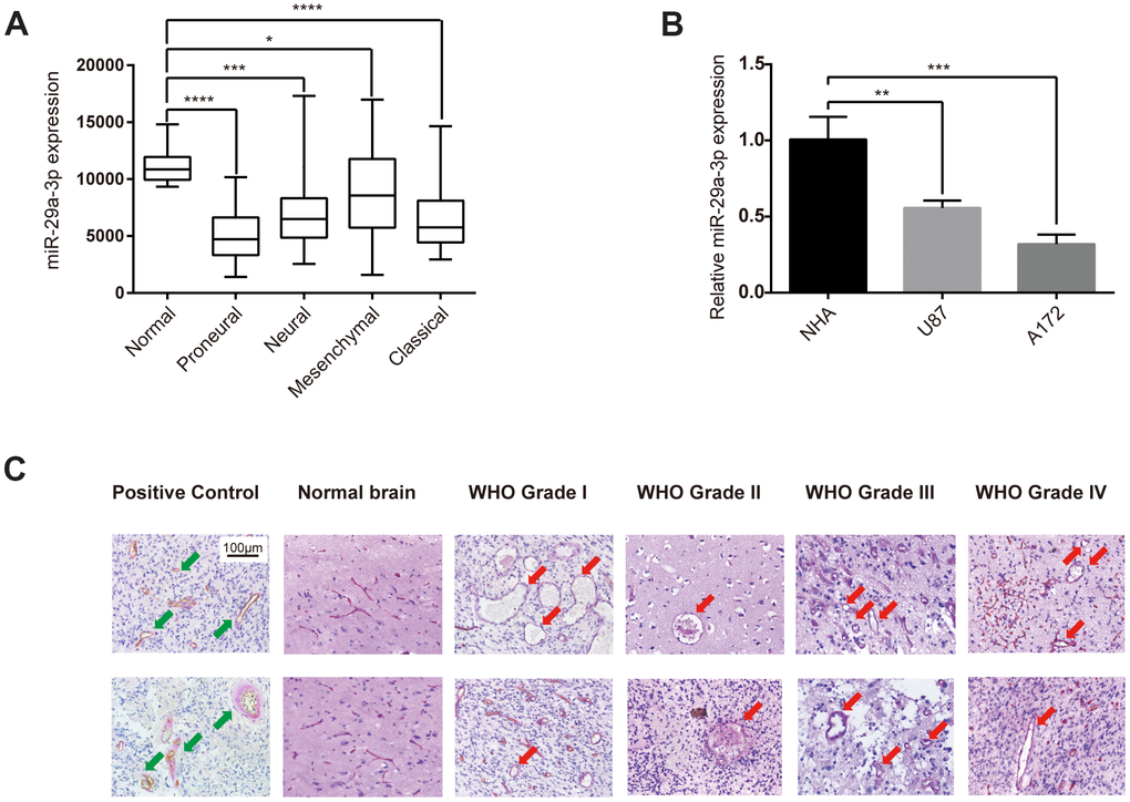 Glioma formed VM structures and showed aberrantly low expression level of miR-29a-3p. (A) Quantification of miR-29a-3p expression levels in gliomas of different subtypes in the TCGA database. Data are shown as the mean±SD, n=204, one-way ANOVA (*, P B) miR-29a-3p expression in NHA, U87 and A172 cells. Data are shown as the mean±SD, n=3, one-way ANOVA (*, P C) Representative images of CD34-PAS IHC staining of VM structures (red arrows; scale bar, 100 μm) in normal brain specimens (n=2) and in gliomas of different grades (n=45). Epithelium-lined vessels (CD34+/PAS+) were set as positive control (green arrows; scale bar, 100 μm).