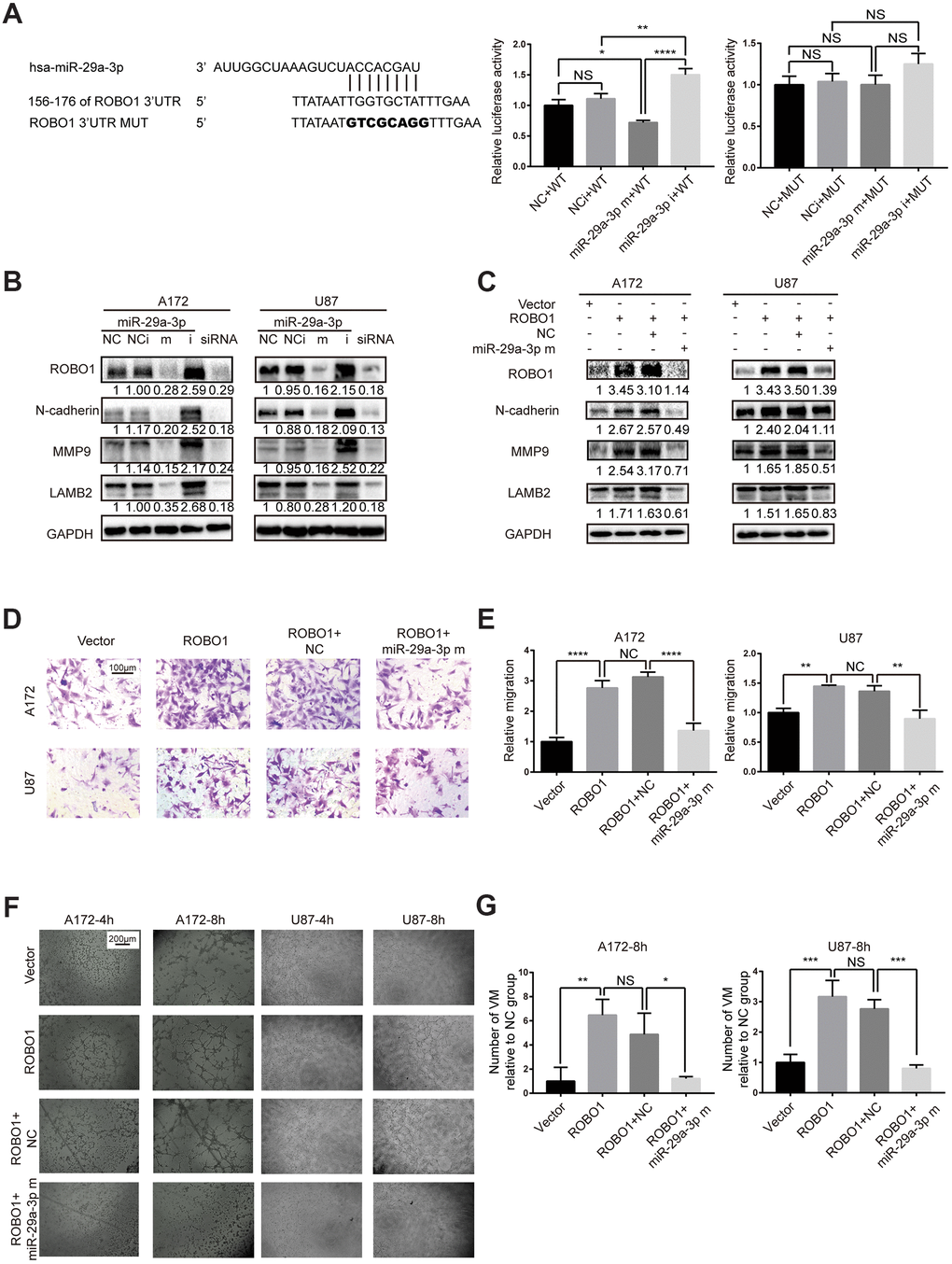 miR-29a-3p inhibited migration and VM formation by directly targeting ROBO1. (A) Schematic representation of the predicted binding sites for miR-29a-3p in the ROBO1 3′-UTR (wild type; WT) and the designed mutant versions (mutant; MUT) of the ROBO1 3’-UTR (left panel). Relative luciferase activity of HEK293T cells in the presence of the indicated treatments (middle and right plots). Data are shown as the mean±SD, n=3, one-way ANOVA (*, P B) Western blot analysis of the protein level of ROBO1,N-cadherin, MMP9 and LAMB2 after miR-29a-3p transfection. Results are from three independent experiments. (C) Western blot analysis of the expression of ROBO1,N-cadherin, MMP9 and LAMB2 after ROBO1 and miR-29a-3p overexpression. Results are from three independent experiments. (D) Representative images for the transwell assay (scale bar, 100 μm; n=3). (E) Quantification of transwell migration assays in (D). Data are shown as the mean±SD, n=3, one-way ANOVA (*, P F) Representative images for the VM formation assay (scale bar, 200 μm; n=3). (G) Quantification of relative VM numbers in (F). Data are shown as the mean±SD, n=3, one-way ANOVA (*, P 