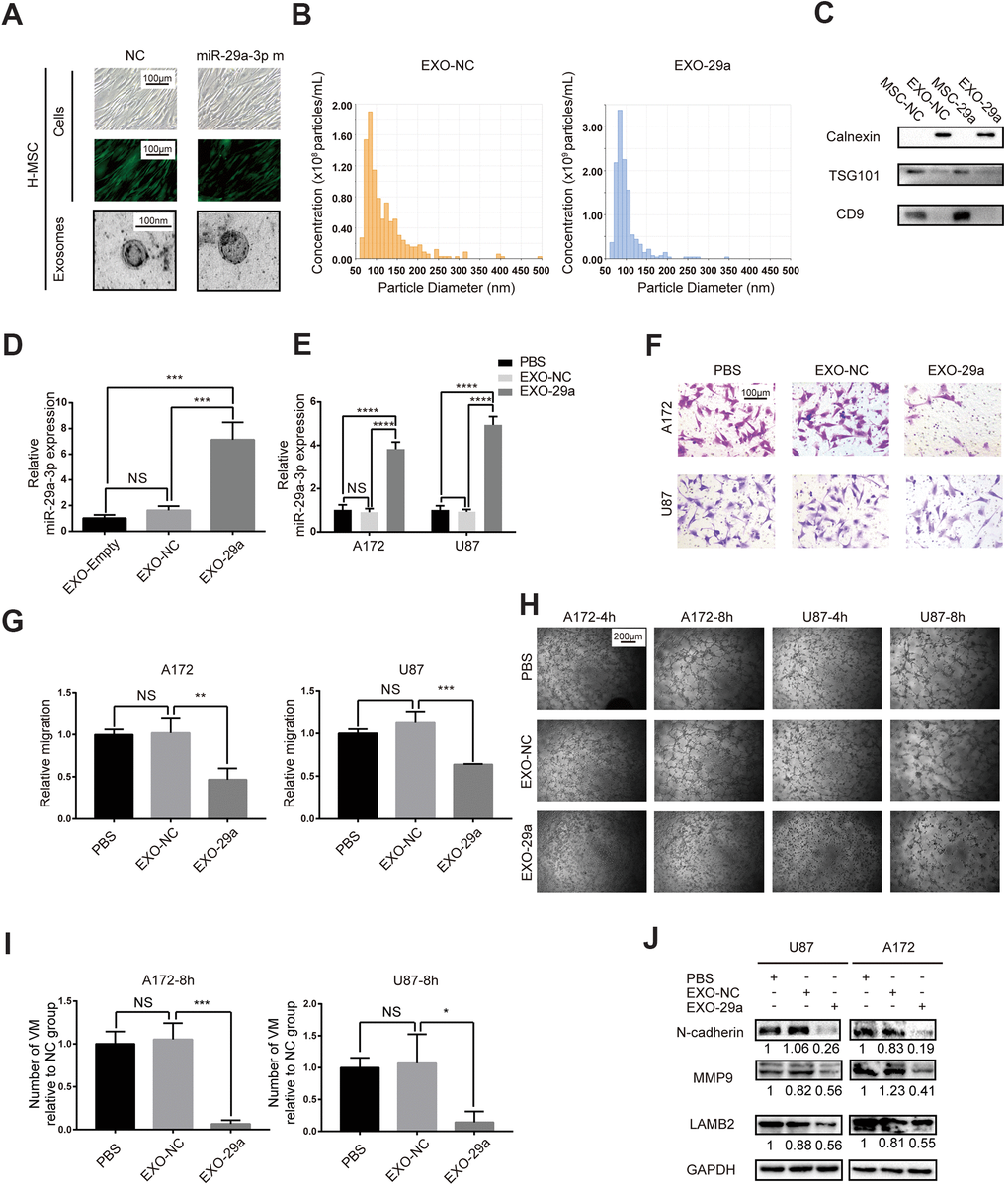 Transfected MSCs transferred miR-29a-3p via exosomes and inhibited migration and VM formation in glioma. (A) Representative images of human MSCs transfected with miR-29a-3p or an NC nucleotide sequence (scale bar, 100 μm) and the corresponding electron microscopic images of exosomes (scale bar=100 nm). (B) Nanoparticle tracking technology indicated an accumulation of particles of diameters of 50-100 nanometres. (C) Western blot analysis showing the presence of TSG101 and CD9 and the absence of calnexin in MSC-derived exosomes. Results are from three independent experiments. (D, E) PCR analysis of the miR-29a-3p level in exosomes (D) and glioma cell lines pretreated with exosomes (E). Data are shown as the mean±SD, n=3, one-way ANOVA (*, P F) Migration capability detected by a transwell assay after treatment with miR-29a-3p-overexpressing exosomes (scale bar, 100 μm; n=3). (G) Quantification of transwell migration assays in (F). Data are shown as the mean±SD, n=3, one-way ANOVA (*, P H) VM formation after treatment with miR-29a-3p-overexpressing exosomes (scale bar, 200 μm; n=3). (I) Quantification of relative VM numbers in (H). Data are shown as the mean±SD, n=3, one-way ANOVA (*, P J) Protein levels of markers of migration and VM formation detected by western blotting after miR-29a-3p-overexpressing exosome (EXO-29a) treatment. Results are from three independent experiments.