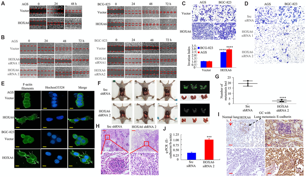 In vitro and in vivo, the effects of HOXA6 on migration and invasion in GC cells. (A, B) Wound healing assay in GC cells transfected with HOXA6 plasmid or HOXA6 siRNA. Relative wound closure was calculated in experiments performed in triplicate. (C, D) Transwell assay conducted in GC cells transfected with HOXA6 plasmid or HOXA6 siRNA. The number of invading cells is shown. Cells in 5 independent symmetrical visual fields from three independent experiments were counted under a microscope. ****, P E) Stable HOXA6 transfectants were stained with rhodamine-phallotoxin to reveal F-actin filaments by fluorescence microscopy. (F) Whole-body fluorescence imaging showing GC progression in mice (n = 3). Metastatic loci in the lungs are detected in the image. (G) Metastatic loci in the lung were calculated. ****, P H) Lung sections were stained with haematoxylin and eosin. (I) The expression of HOXA6 and E-cadherin in the lung metastasis in GC was determined by IHC. (J) qRT-PCR was detected the expression of E-cadherin in lung tumours derived from AGS cells. ***, P H and I.