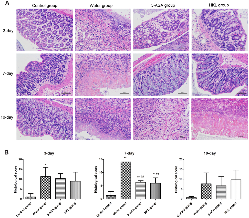 Histological grading of colitis. (A) Representative photographs showing histological score assigned to biopsies, magnification 10X. (B) Sum of inflammation score according to Dieleman scoring system in normal group, 5-ASA group, HKL group and water group after 3 days, 7 days and 10 days treatment (n = 3 at each time points in each group). * P P P 