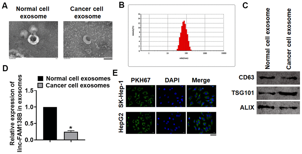 Linc-FAM138B was packaged into exosomes from cancer cells in HCC. Normal and cancer cells were isolated from HCC tissues, then exosomes were isolated from the supernatant of normal and cancer cells. (A) TEM images of exosomes isolated from normal and cancer cells. Scale bar, 100 nm. (B) Zetasizer Nano ZS was used to detect the diameter of isolated exosomes. (C) Western blot for exosome markers CD63, Tsg101 and Alix. (D) The expression of linc-FAM138B in exosomes from normal cells and cancer cells was tested by qRT-PCR. (E) PKH67 labeled linc-FAM138 was transfected into tumor cells. Then, SK-Hep-1 and HepG2 were incubated with exosomes from supernatant of tumor cells. And immunofluorescence experiment indicated a dominant fluorescence intensity of PKH67 in SK-Hep-1 and HepG2 cells. Scale bar, 100 μm. Data are mean ± SD; *P 