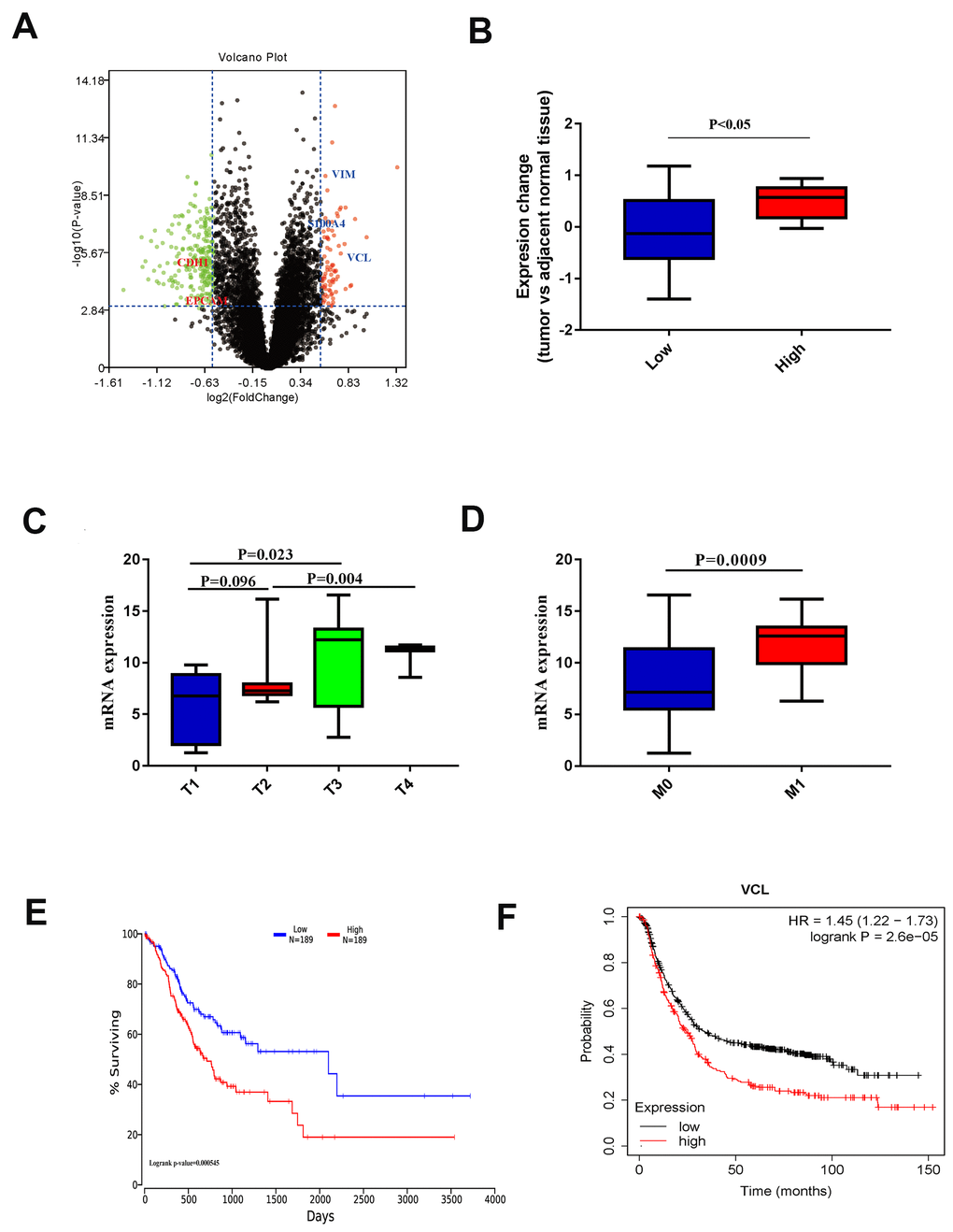 (A) Volcano plot of different EMT histone protein expression. (B) Protein expression of VCL in different EMT groups. (C) VCL expression in different T stages. (D) VCL expression in different M stages. (E) Kaplan-Meier survival curves of overall survival in TCGA GC patients based on VCL mRNA expression. Log-rank test was used to compare differences between two groups. (F) Kaplan-Meier survival curves of overall survival in GEO GC patients based on VCL mRNA expression. Log-rank test was used to compare differences between two groups.