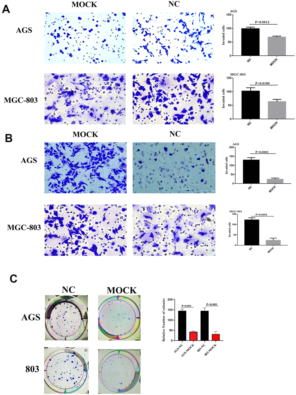 (A) Migrative ability of AGS and MGC-803 of VCL silent group and blank group. (B) Invasive ability of AGS and MGC-803 of VCL silent group and blank group. (C) Colony formation of AGS and MGC-803 of VCL silent group and blank group.