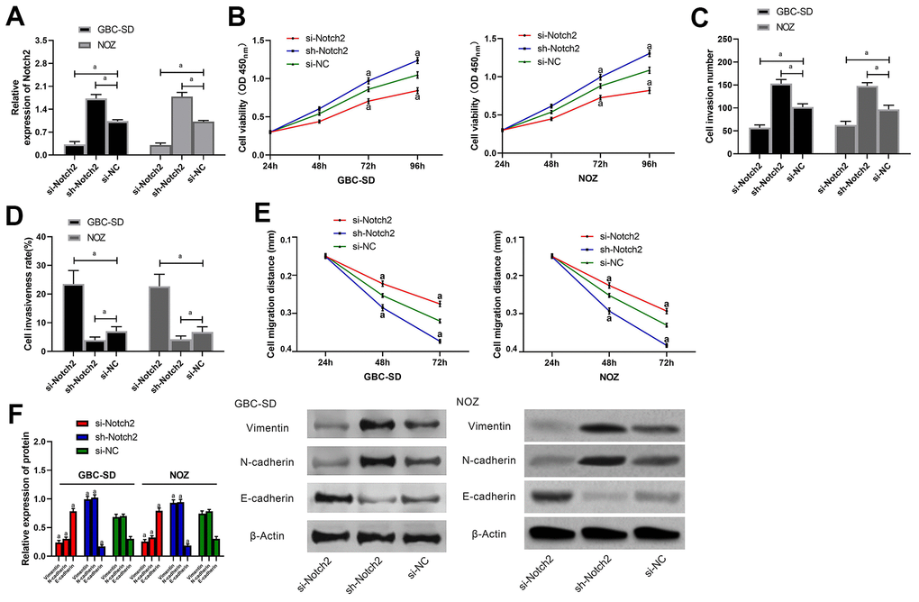 Effects of Notch2 on biological functions of gallbladder carcinoma cells. (A) Expression of Notch2 in GBC-SD and NOZ cells after miR transfection was detected by western blot; (B) Proliferation of GBC-SD and NOZ cells after transfection was measured by CCK-8 assay; (C) Membrane penetration of GBC-SD and NOZ cells after transfection was measured by transwell assay; (D) Apoptosis rates of GBC-SD and NOZ cells after transfection by flow cytometry; (E) Migration of GBC-SD and NOZ cells after transfection was analyzed by cell scratch assay; (F) Expression of Vimentin, N-cadherin and E-cadherin, in GBC-SD and NOZ cells after transfection by western blot. a indicates in comparison with the si-NC group, p