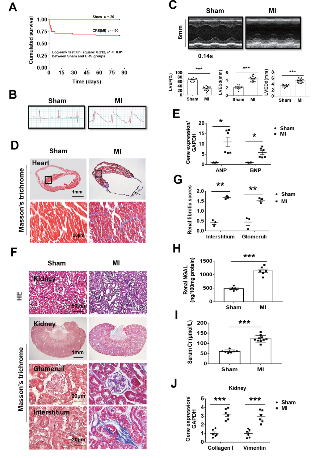 Fibrosis and dysfunction of the heart and kidneys in mice with cardiorenal syndrome (CRS) after surgically induced myocardial infarction (MI) at 12 weeks. (A) Survival rate for 12 weeks in Sham and CRS groups. (B) Representative electrocardiogram showing the ST-segment elevation in MI group. (C) Representative M-mode echocardiographic images. Left ventricular ejection fraction (LVEF), left ventricular end-systolic diameter (LVESd), and left ventricular end-diastolic diameter (LVEDd). ***P D) Myocardial fibrosis detected by Masson’s trichrome staining in both the infarct zone (arrow) and the remote area (black frames). The lower panels are magnified views of the remote area (corresponding to black frames in the upper panels). (E) Quantitative real-time PCR for ANP and BNP mRNA in the heart. *P F) Representative photomicrographs of hematoxylin-eosin staining (HE) and Masson-trichrome staining of kidney sections from sham and CRS groups show structural changes and fibrosis due to CRS. (G) Semi-quantitative analysis of renal fibrosis. **P H) Renal NGAL level in renal tissue. (I) Serum creatinine level in mice measured by ELISA. For (H and I), ***P J) Quantitative real-time PCR for Collagen I and Vimentin mRNA in the kidneys. ***P 